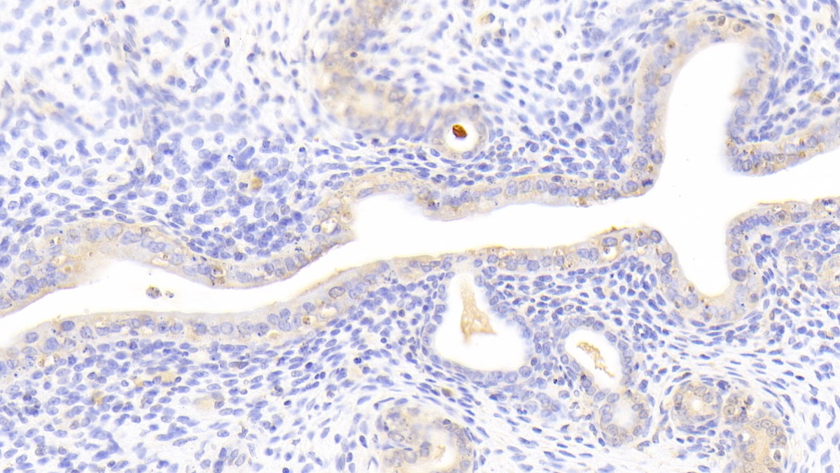 Polyclonal Antibody to Hyaluronoglucosaminidase 1 (HYAL1)