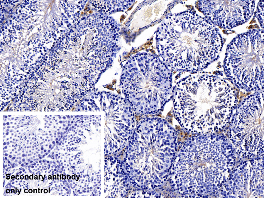 Polyclonal Antibody to Notch2 N-Terminal Like Protein (NOTCH2NL)