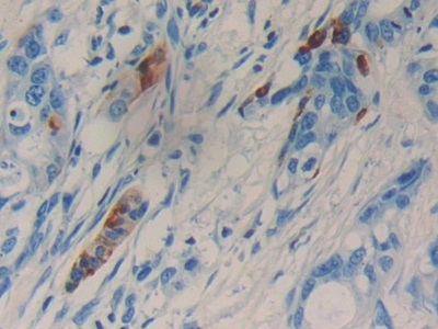 Polyclonal Antibody to Lipocalin 15 (LCN15)