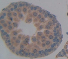 Polyclonal Antibody to Lipocalin 5 (LCN5)