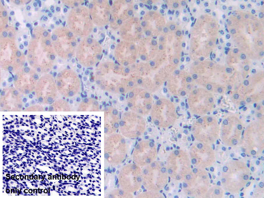 Polyclonal Antibody to Ubiquitin Carboxyl Terminal Hydrolase L4 (UCHL4)