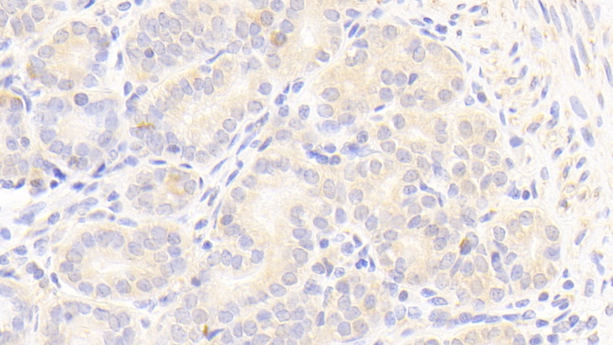 Polyclonal Antibody to Occludin/ELL Domain Containing Protein 1 (OCEL1)