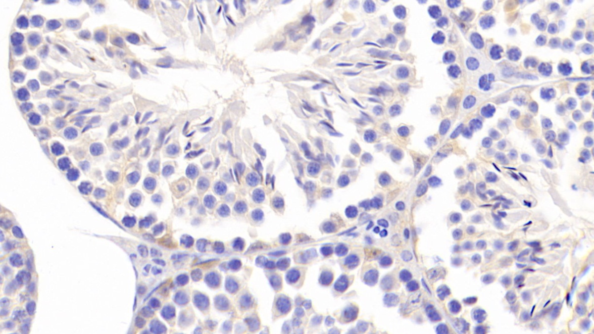 Polyclonal Antibody to Coiled Coil Domain Containing Protein 60 (CCDC60)