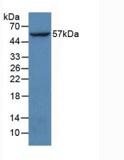 Anti-Phosphorylated Protein Kinase B Alpha (PKBa) Polyclonal Antibody