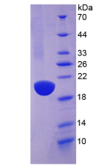 Active Angiotensin I Converting Enzyme (ACE)