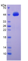 Active Brain Derived Neurotrophic Factor (BDNF)