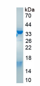 Active Fibronectin (FN)