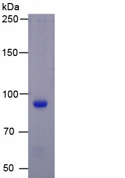 Active Fibronectin (FN)