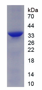 Active Fibronectin (FN)