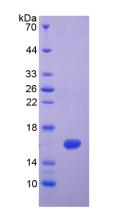 Active Interferon Gamma (IFNg)