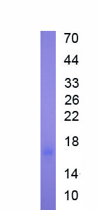 Active Interleukin 2 (IL2)