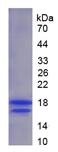 Active Interleukin 2 (IL2)