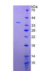 Active Interleukin 4 (IL4)