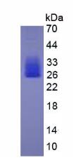 Active Interleukin 6 (IL6)