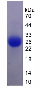 Active Interleukin 6 (IL6)