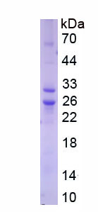 Active Interleukin 6 (IL6)