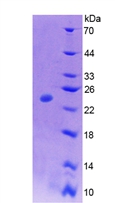 Active Colony Stimulating Factor 1, Macrophage (MCSF)