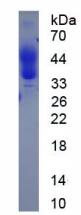 Active Colony Stimulating Factor 1, Macrophage (MCSF)