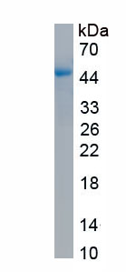 Active Matrix Metalloproteinase 1 (MMP1)