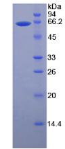 Active Matrix Metalloproteinase 2 (MMP2)