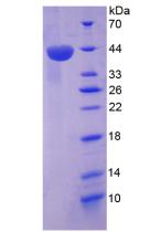 Active Stromal Cell Derived Factor 1 (SDF1)