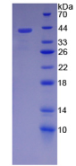 Active Stromal Cell Derived Factor 1 (SDF1)