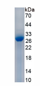 Active Tissue Inhibitors Of Metalloproteinase 2 (TIMP2)