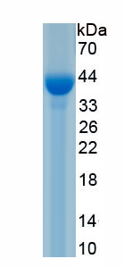 Active Tissue Inhibitors Of Metalloproteinase 2 (TIMP2)