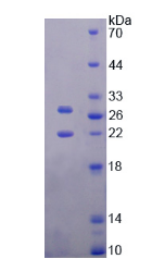 Active Tissue Inhibitors Of Metalloproteinase 3 (TIMP3)