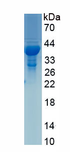 Active Thrombopoietin (TPO)