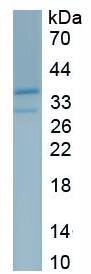 Active Plasminogen Activator, Urokinase Receptor (uPAR)