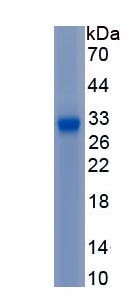 Active Collagen Type IV Alpha 1 (COL4a1)