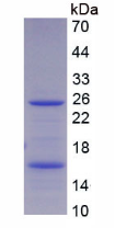 Active Carcinoembryonic Antigen (CEA)