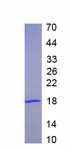 Active Interleukin 1 Receptor Antagonist (IL1RA)