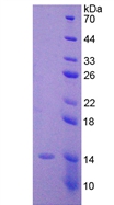 Active Anti-Mullerian Hormone (AMH)