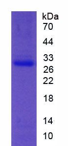 Active Paraoxonase 1 (PON1)