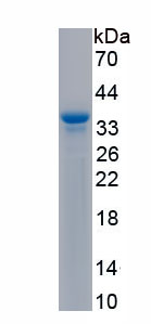 Active Annexin V (ANXA5)