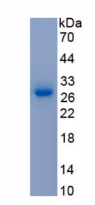 Active Neutrophil Cytosolic Factor 2 (NCF2)