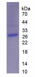 Active Galectin 3 (GAL3)