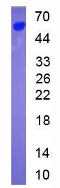 Active Cathepsin A (CTSA)