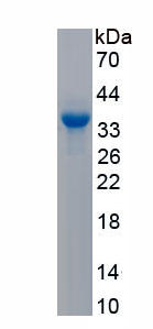 Active Tissue Factor Pathway Inhibitor (TFPI)