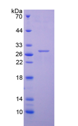 Active Cardiac Troponin I (cTnI)