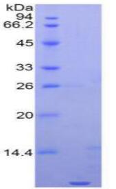 Active N-Terminal Pro-Brain Natriuretic Peptide (NT-ProBNP)