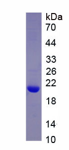 Active Tissue Inhibitors Of Metalloproteinase 1 (TIMP1)