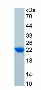 Active Tissue Inhibitors Of Metalloproteinase 1 (TIMP1)