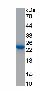 Active Tissue Inhibitors Of Metalloproteinase 1 (TIMP1)