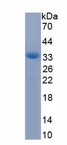 Active Nitric Oxide Synthase Trafficker (NOSTRIN)