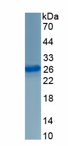 Active Glutathione S Transferase Mu 1 (GSTM1)