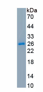 Active Glutathione S Transferase Mu 1 (GSTM1)