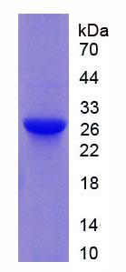 Active Glutathione S Transferase Mu 1 (GSTM1)